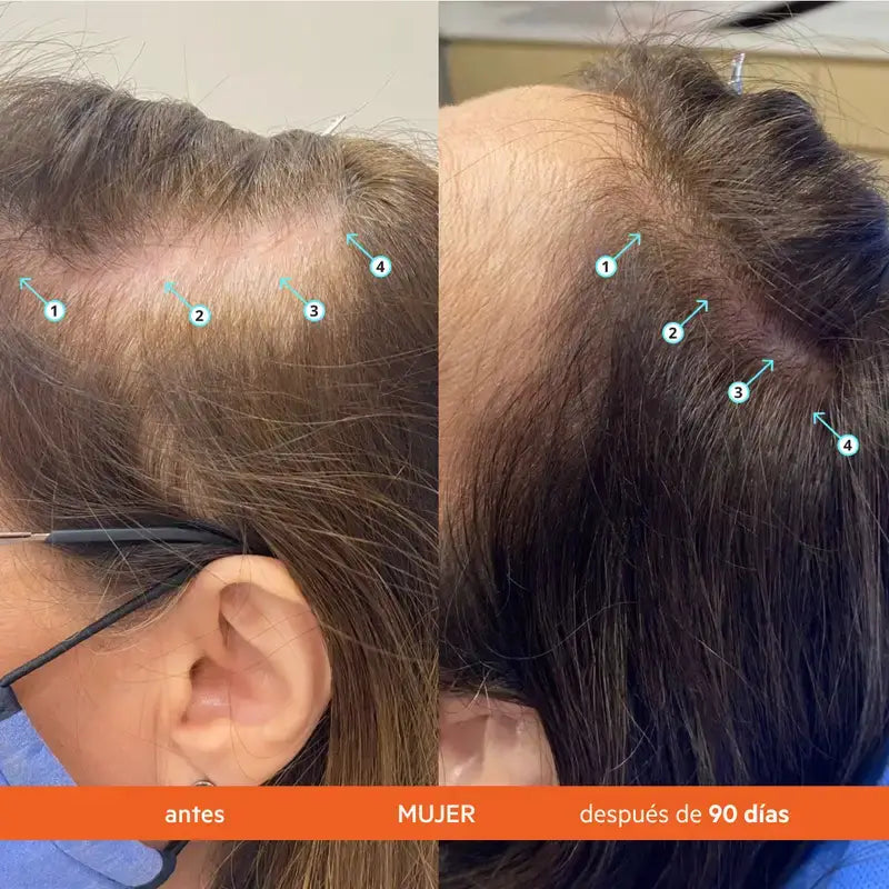 Ds Laboratoires REVITA Shampooing stimulant la chute des cheveux 925ML