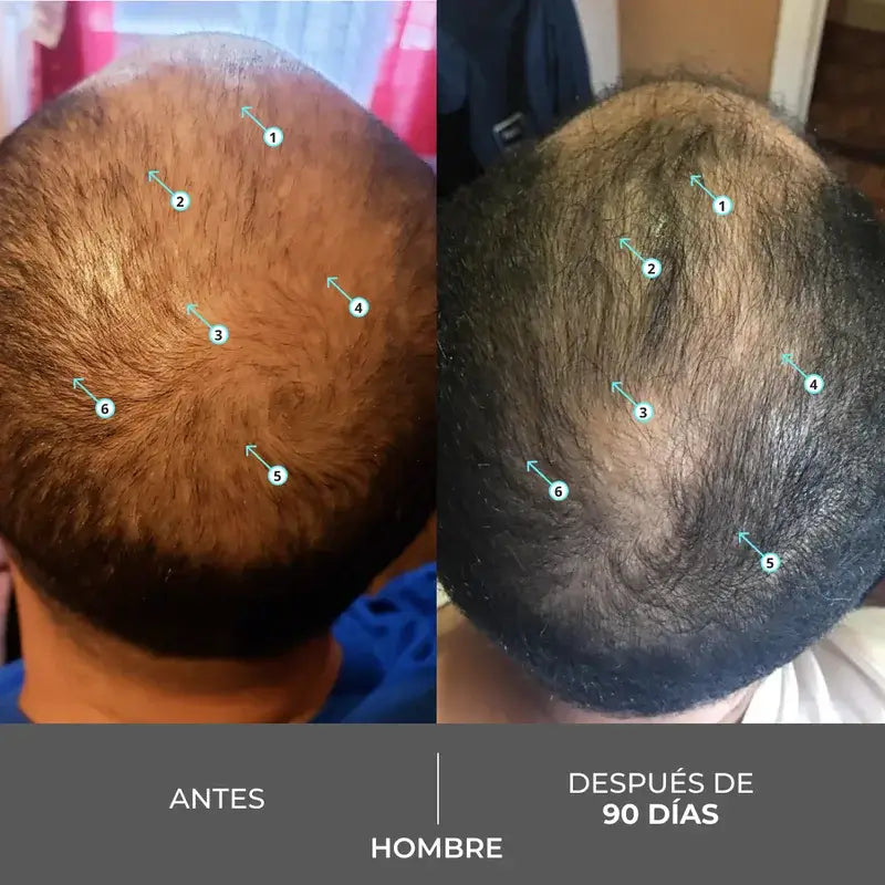 Ds Laboratories Revita Hair Density Stimulating Hair Loss Stimulating Shampoo, 205 ml