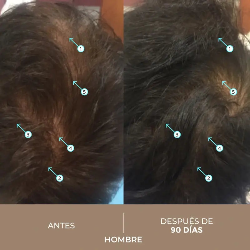 Ds Laboratories Spectral Lotion Spectral Dnc-N 5% Nanoxidil® Traitement de la chute des cheveux, 60 ml