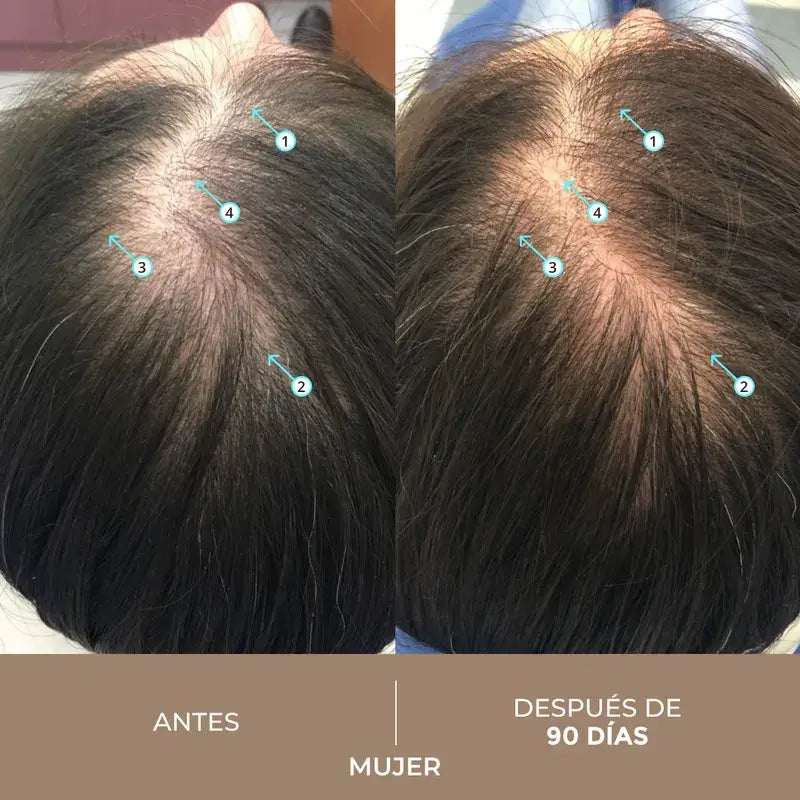 Ds Laboratories Spectral Lotion Spectral Dnc-N 5% Nanoxidil® Traitement de la chute des cheveux, 60 ml