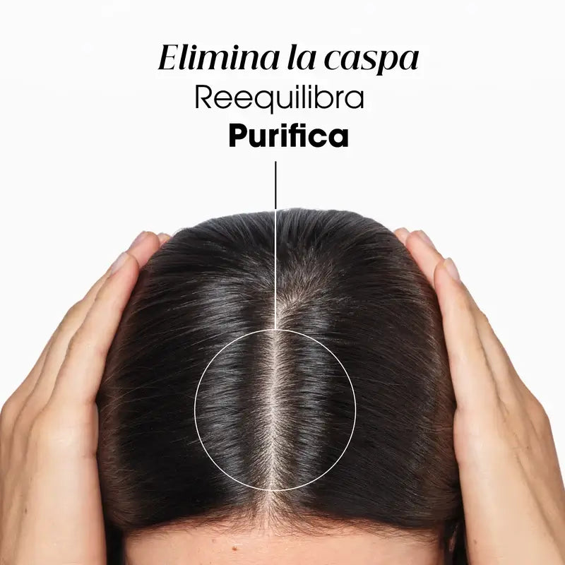 Klorane Antipelliculaire Shampooing Rééquilibrant A La Galanga, 400 ml