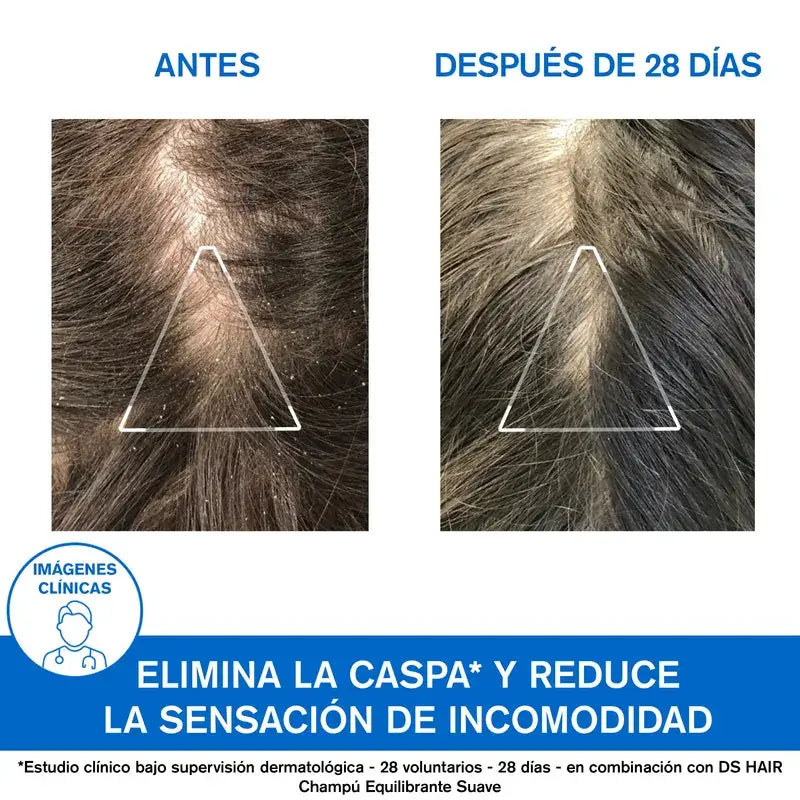 Uriage Ds Hair Shampooing traitant antipelliculaire 200Ml